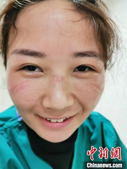 护士病房唱豫剧庆祝患者出院 网友赞“当代穆桂英”