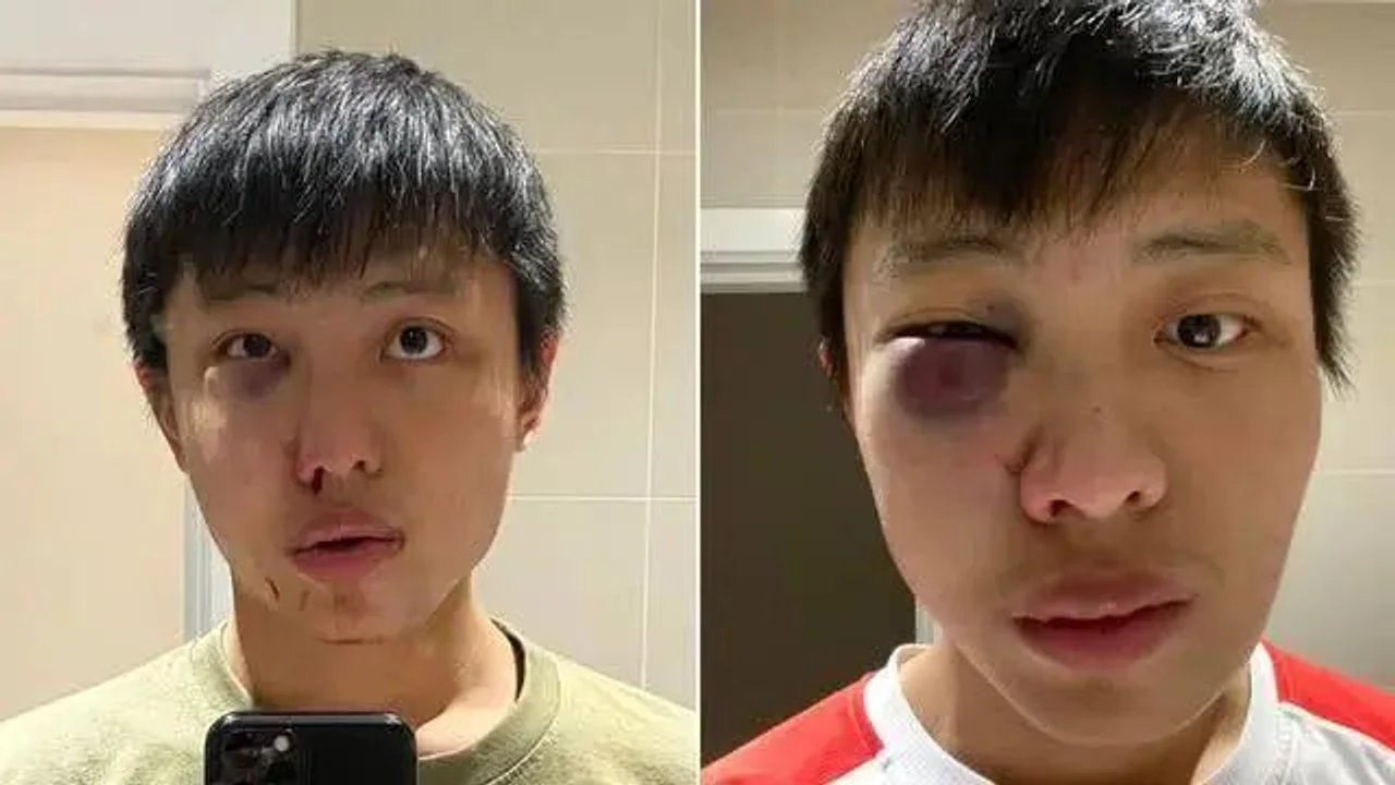 这个案子令世卫总干事震惊,英国警方已公布嫌犯照片