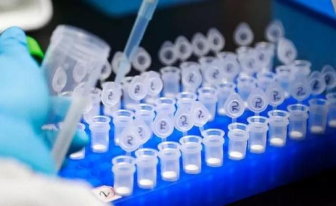 约翰斯·霍普金斯大学：全球确诊病例已超过150万例