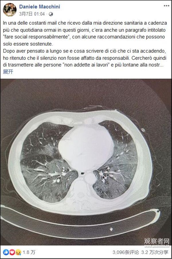 意大利医生怒了：别再说什么大号流感了，我们都忙疯了！