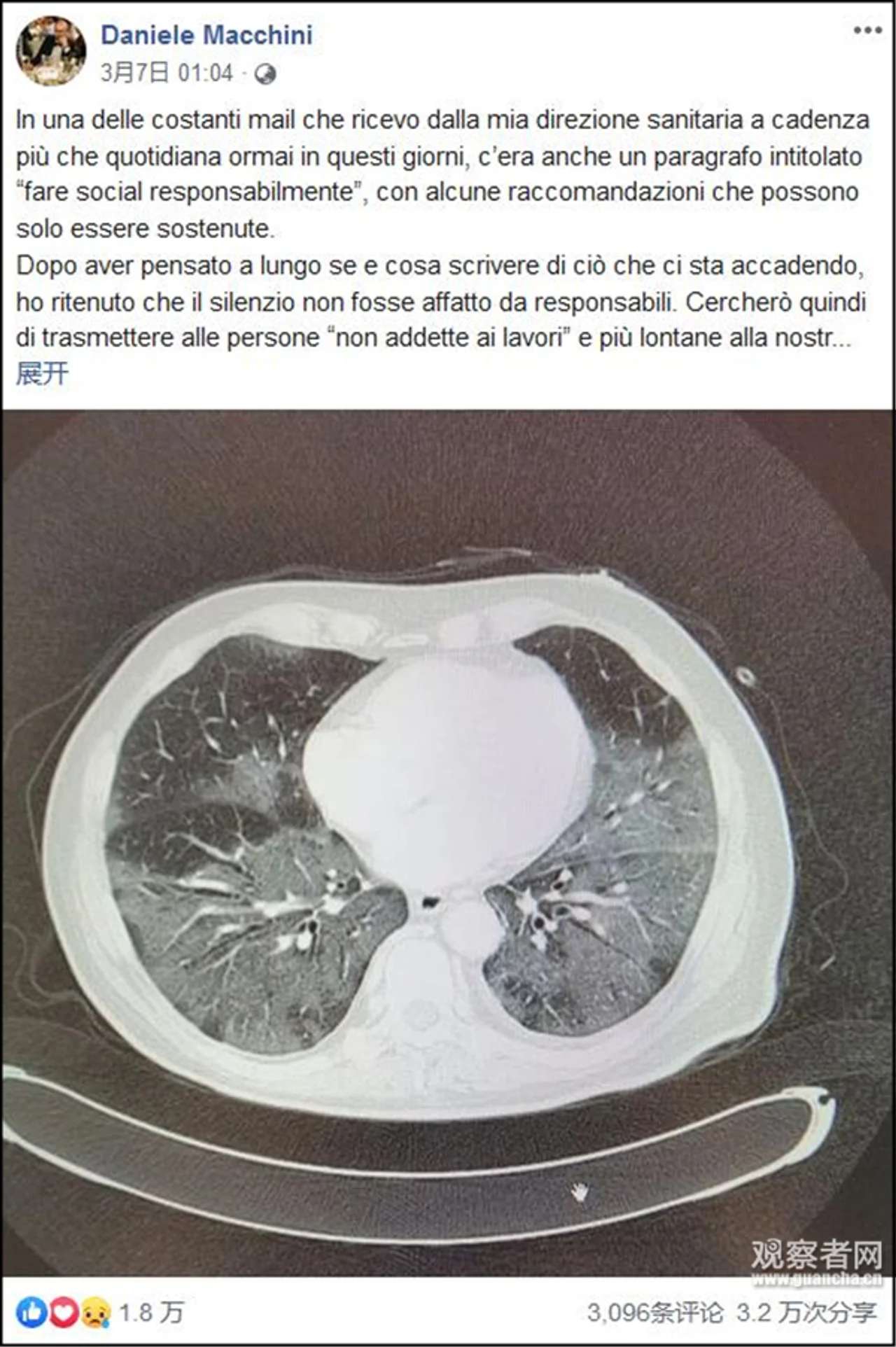 意大利医生怒了:别再说什么大号流感了,我们都忙疯了!