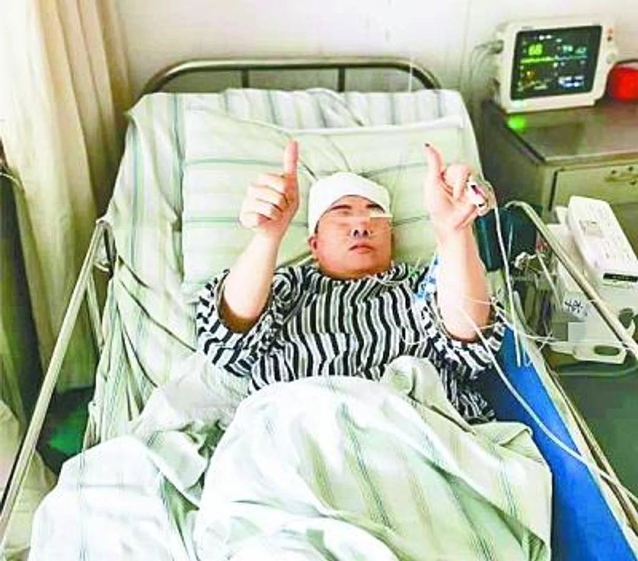 突发剧烈头痛查出动脉瘤 手术后她为医生竖起大拇指