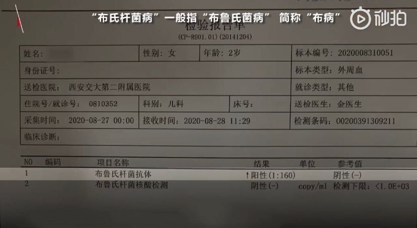 2岁女童被确诊为布氏杆菌病 和饮用现挤羊奶有关