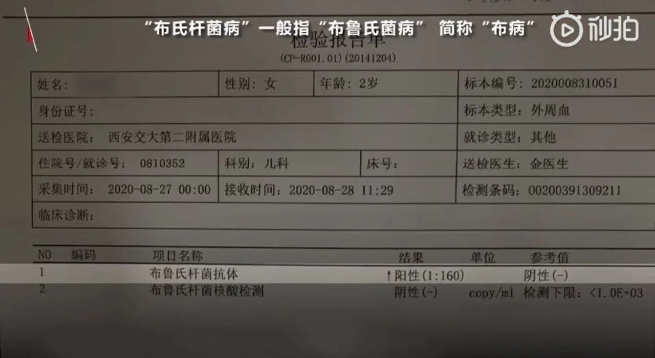 2岁女童被确诊为布氏杆菌病 和饮用现挤羊奶有关