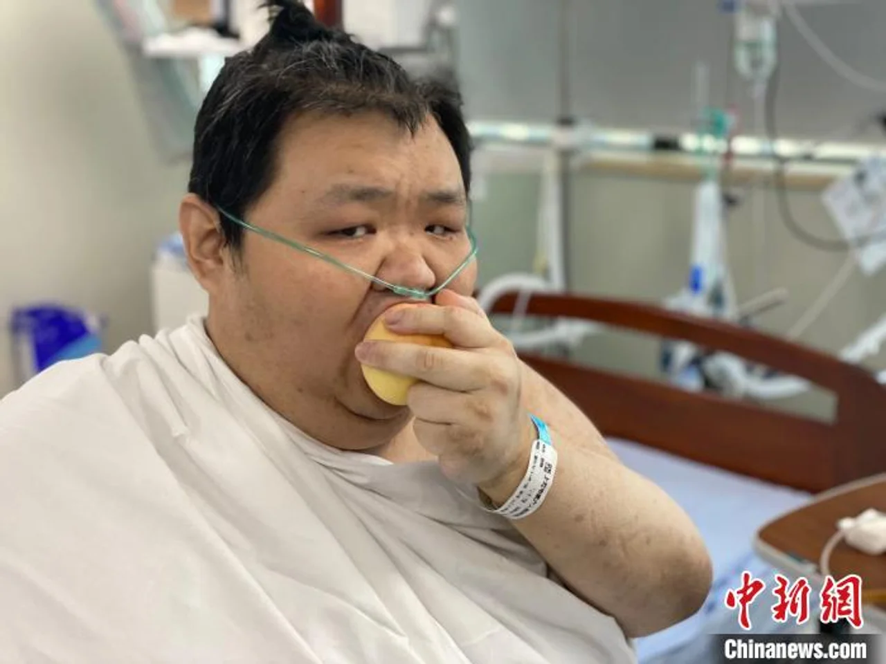 上海五百多斤胖小伙成功接受“减重手术”已瘦一百斤