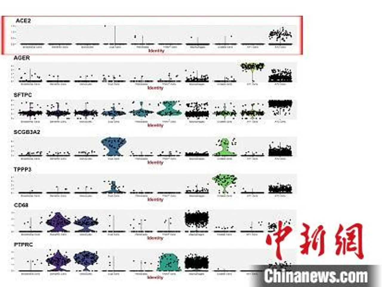 新冠病毒很狡猾 有研究称病毒率先攻击人体深处肺泡