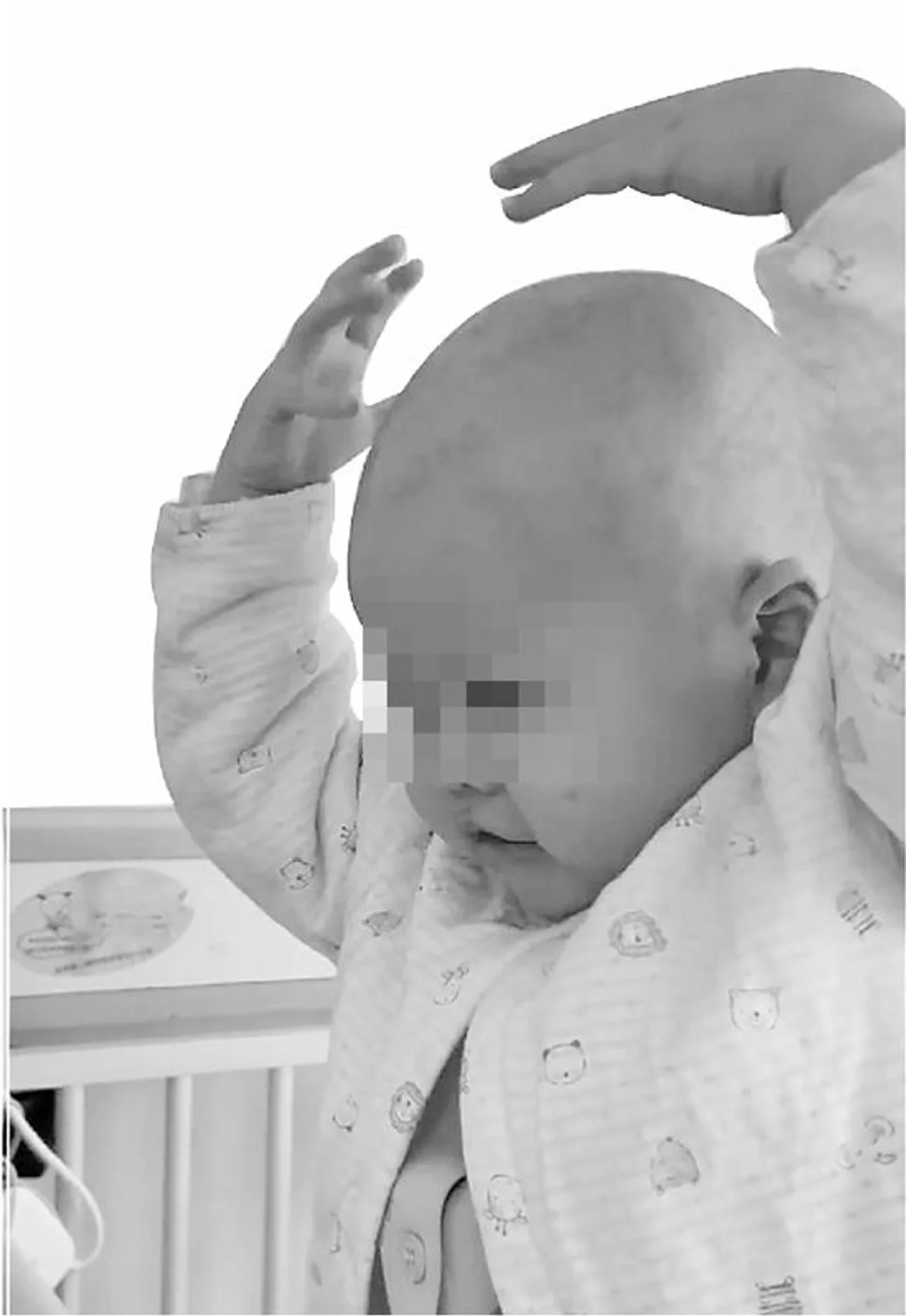 3岁患白血病宝宝鼓励病友:光头也是很漂亮的呀
