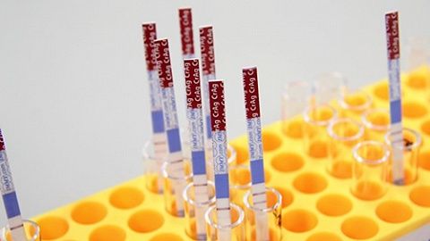贝索斯、盖茨呼吁的大规模测试来了！美国FDA紧急批准新抗原测...