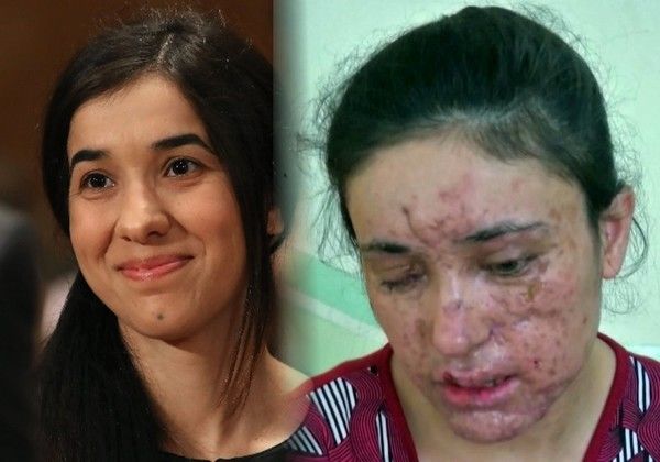 曾被ISIS擄走充當性奴　兩伊拉克女子獲頒人權獎