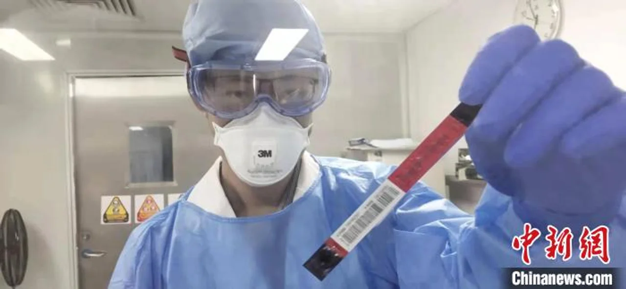 化学发光新冠病毒检测试剂盒在深研发成功 22分钟出结果