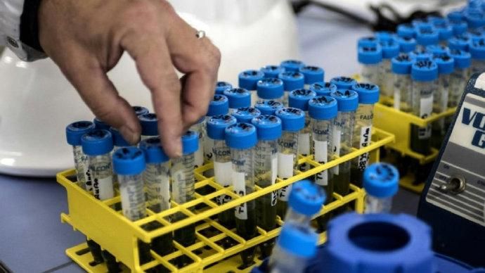 英国单日新增确诊病例数再创新高，单日死亡病例破千例